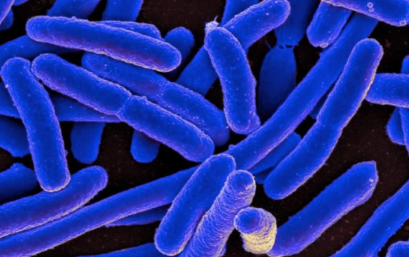 Escherichia coli / Credit: NIAID