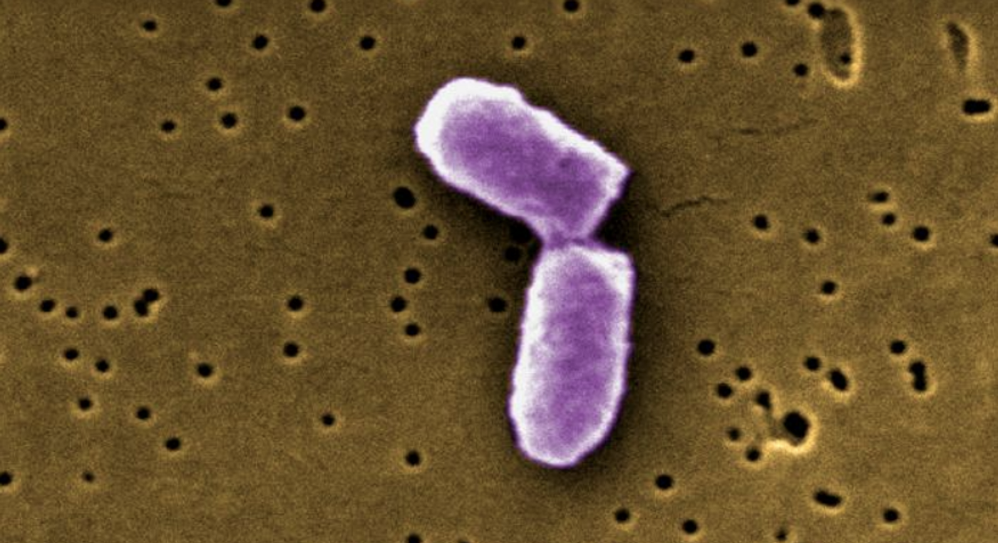E. coli bacteria / Image credit: CDC/Evangeline Sowers, Janice Haney Carr