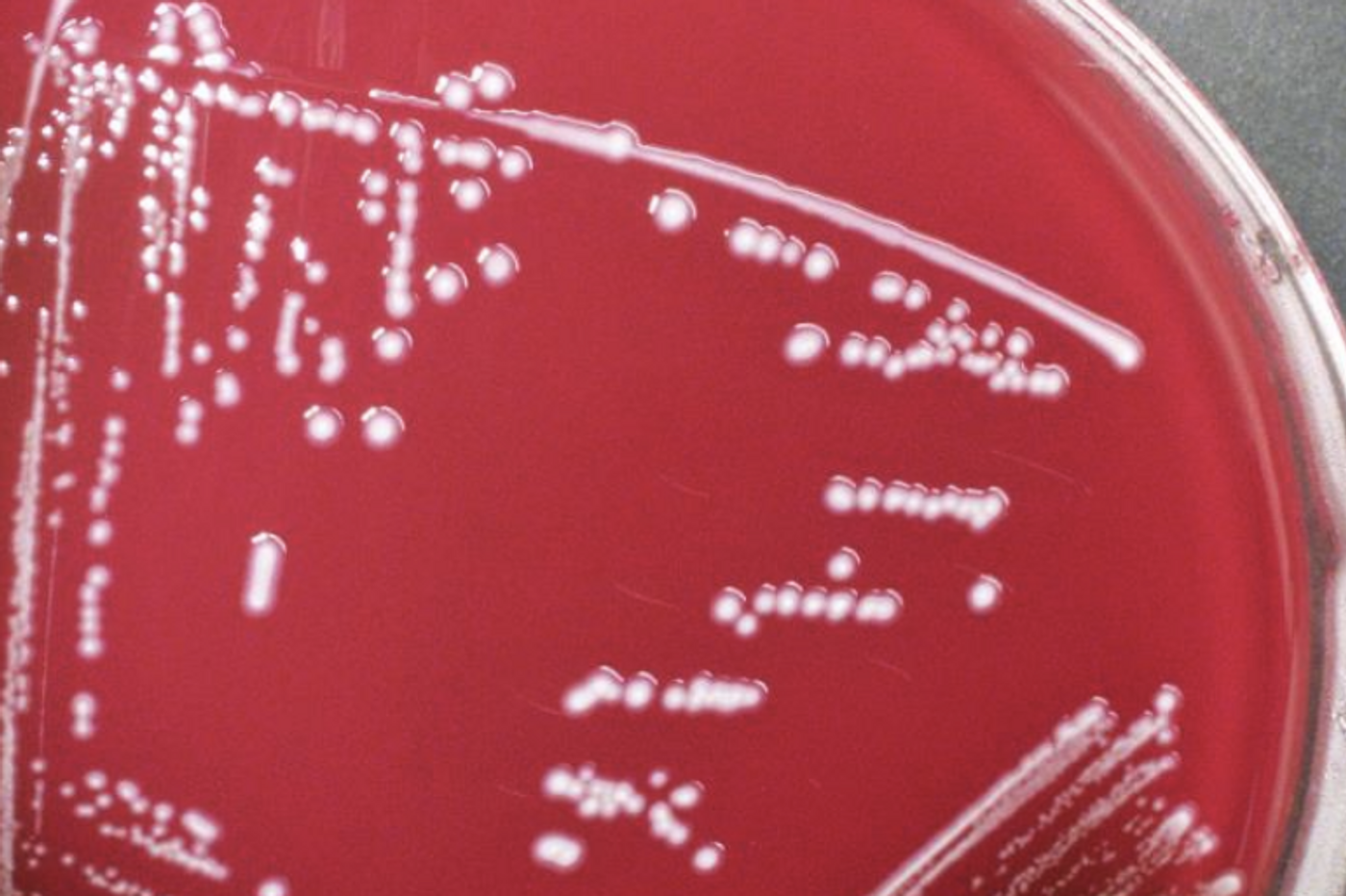 Paenibacillus macerans bacteria cultured on sheep blood agar medium,/ Credit: CDC/ Todd Parker, Ph.D., Assoc Director for Laboratory Science, Div of Preparedness and Emerging Infections at CDC