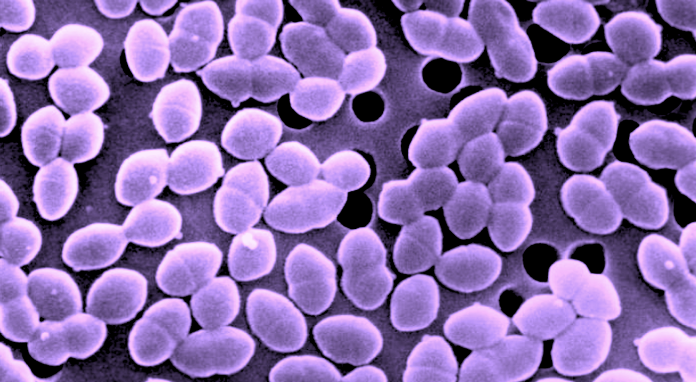An SEM image depicting Enterococcus sp. bacteria. / Credit: Modified content from CDC/ Janice Haney Carr