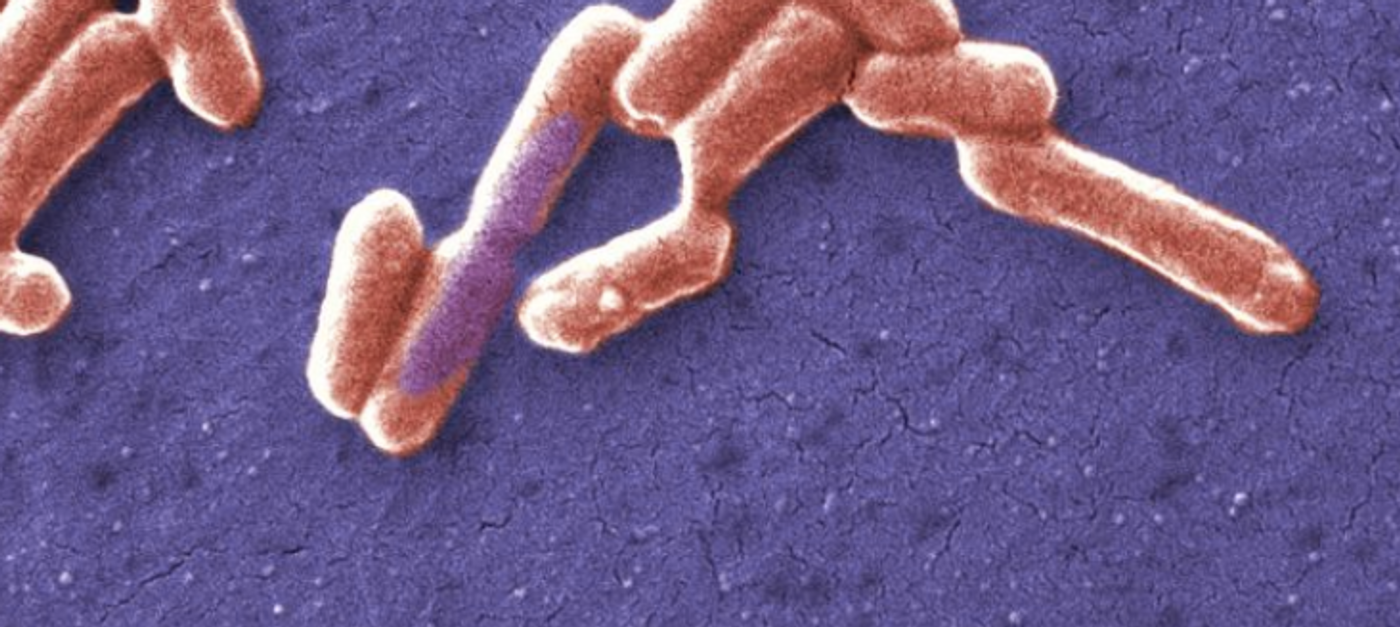 Cropped from a Public domain image by Janice Haney Carr, National Escherichia, Shigella, Vibrio Reference Unit at CDC, USCDCP