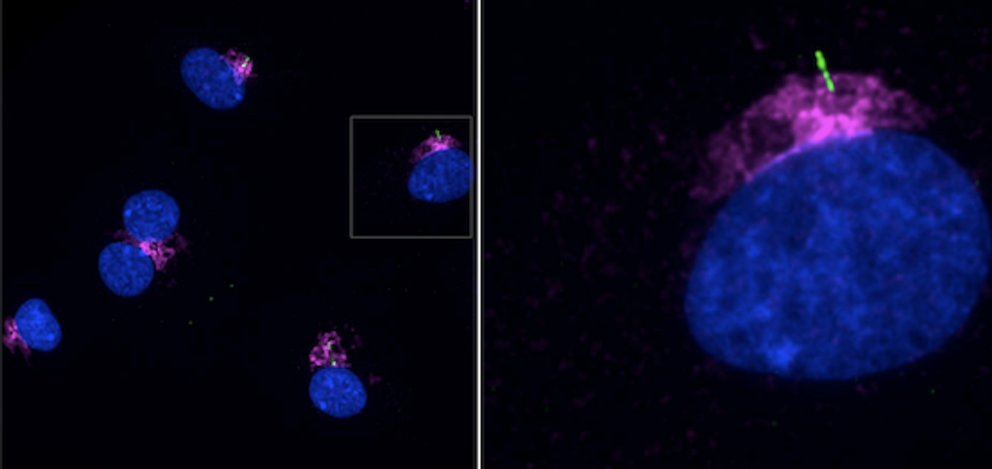 Primary cilia are seen on human LECs in this image by Paulson et al Front. Cell Dev. Biol., 14 May 2021, the ciliary marker ARL13b (green), DNA (blue) IFT20 (purple)