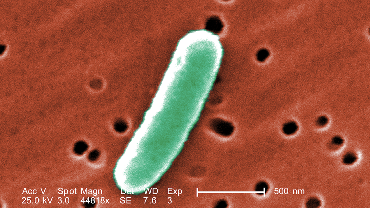  Escherichia coli bacterium.  / Credit: CDC/ Janice Haney Carr