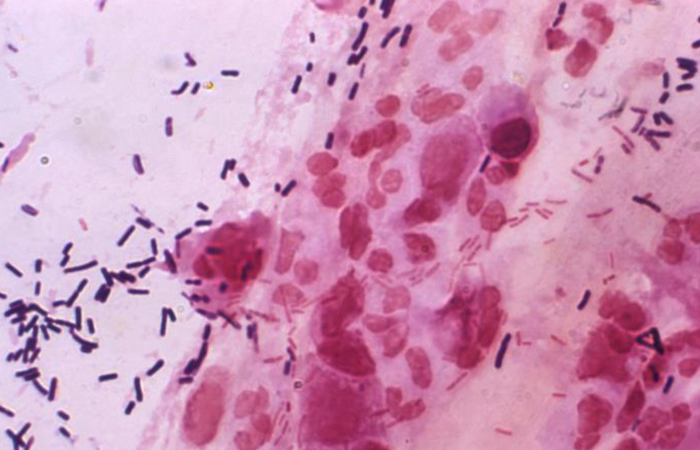 Lactobacilli appear purple in this image / Credit: CDC/ Joe Miller 