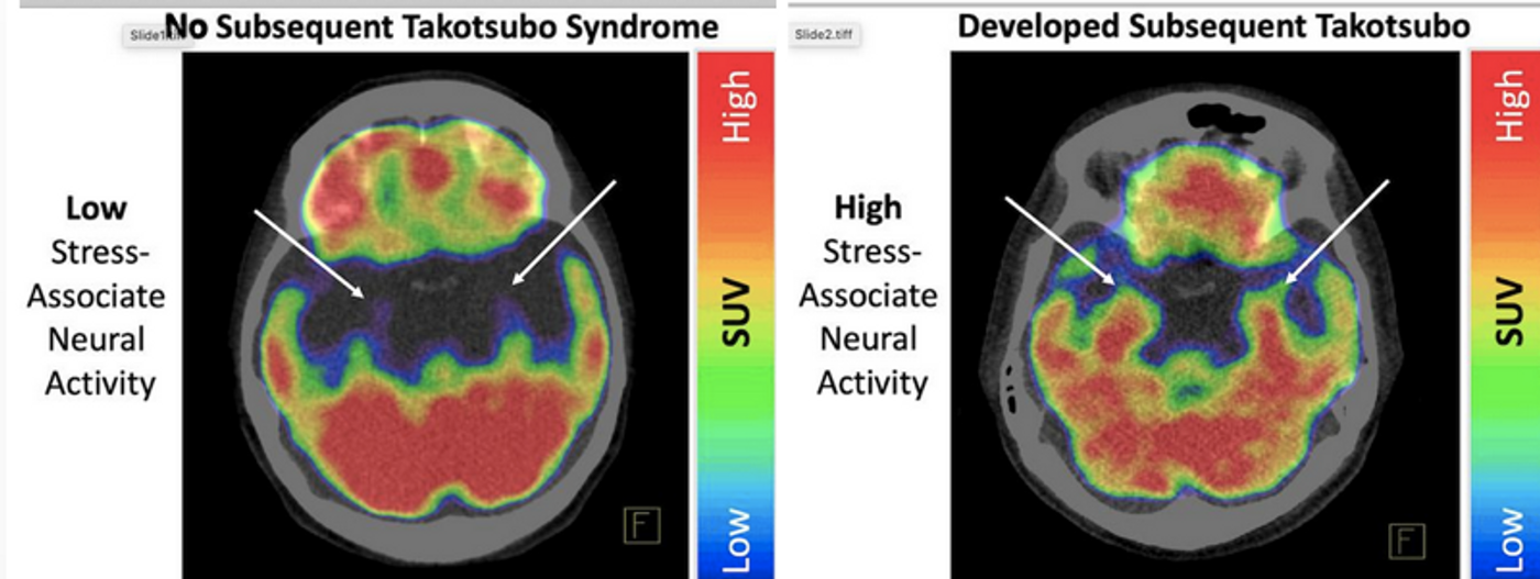 Image credit: Modified from European Heart Journal