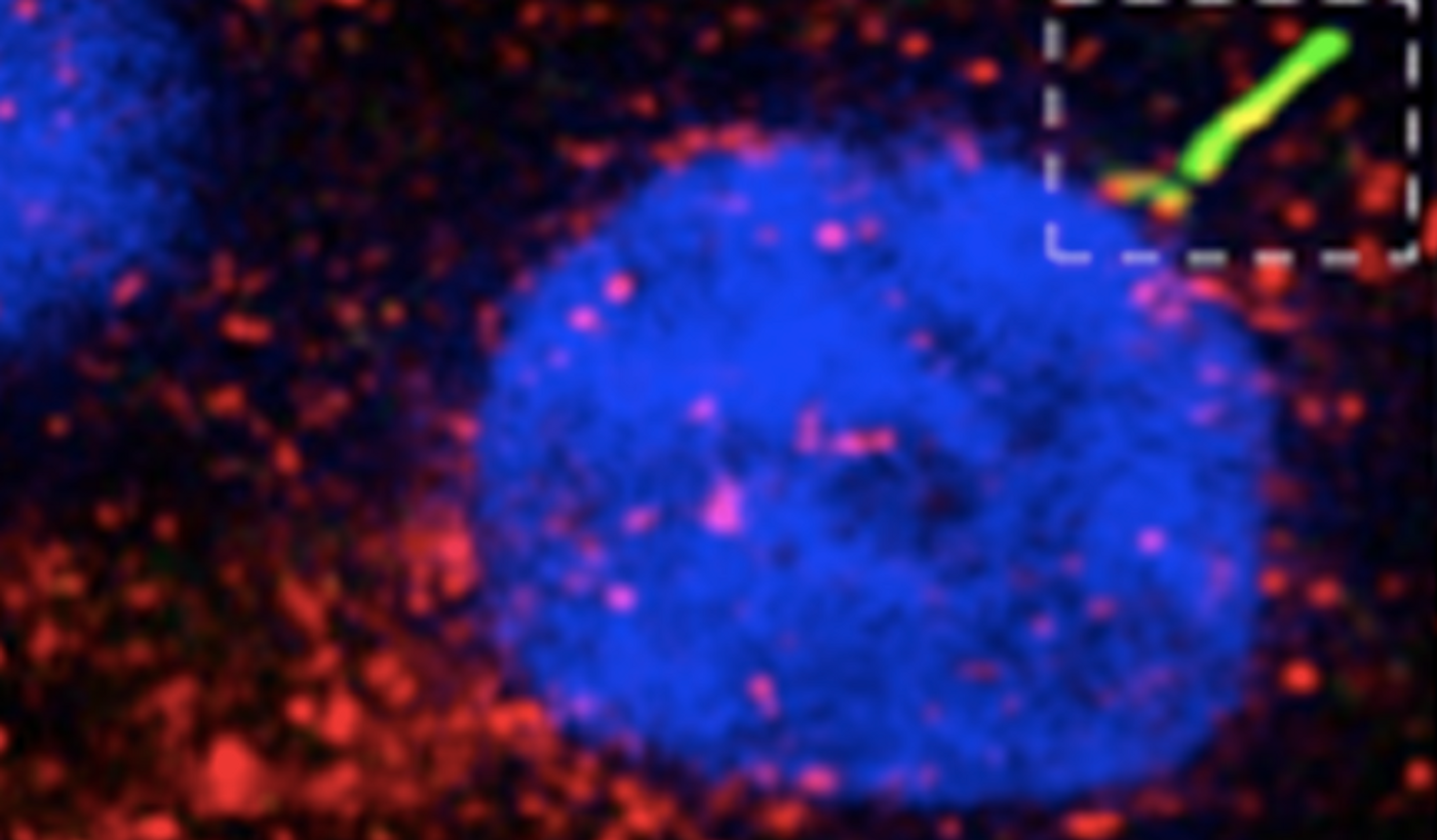 A primary cilium is highlighted on a cell / Image credit: Carmen Leitch