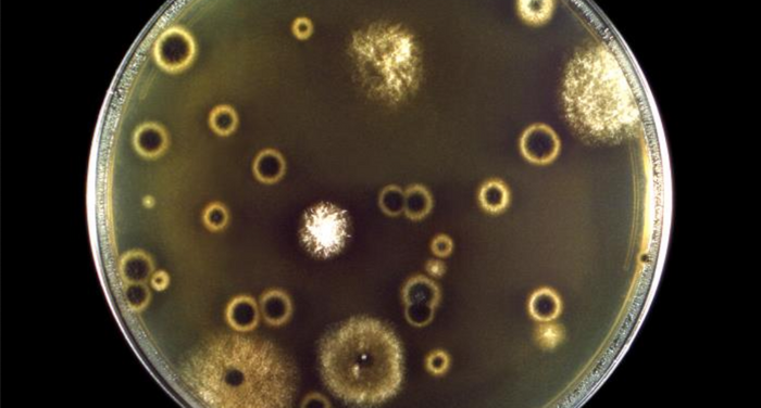 Cryptococcus neoformans fungal organisms growing in a Petri dish containing Ajello-Shields growth medium / Credit: Centers for Disease Control and Prevention (CDC) / Dr. Libero Ajello