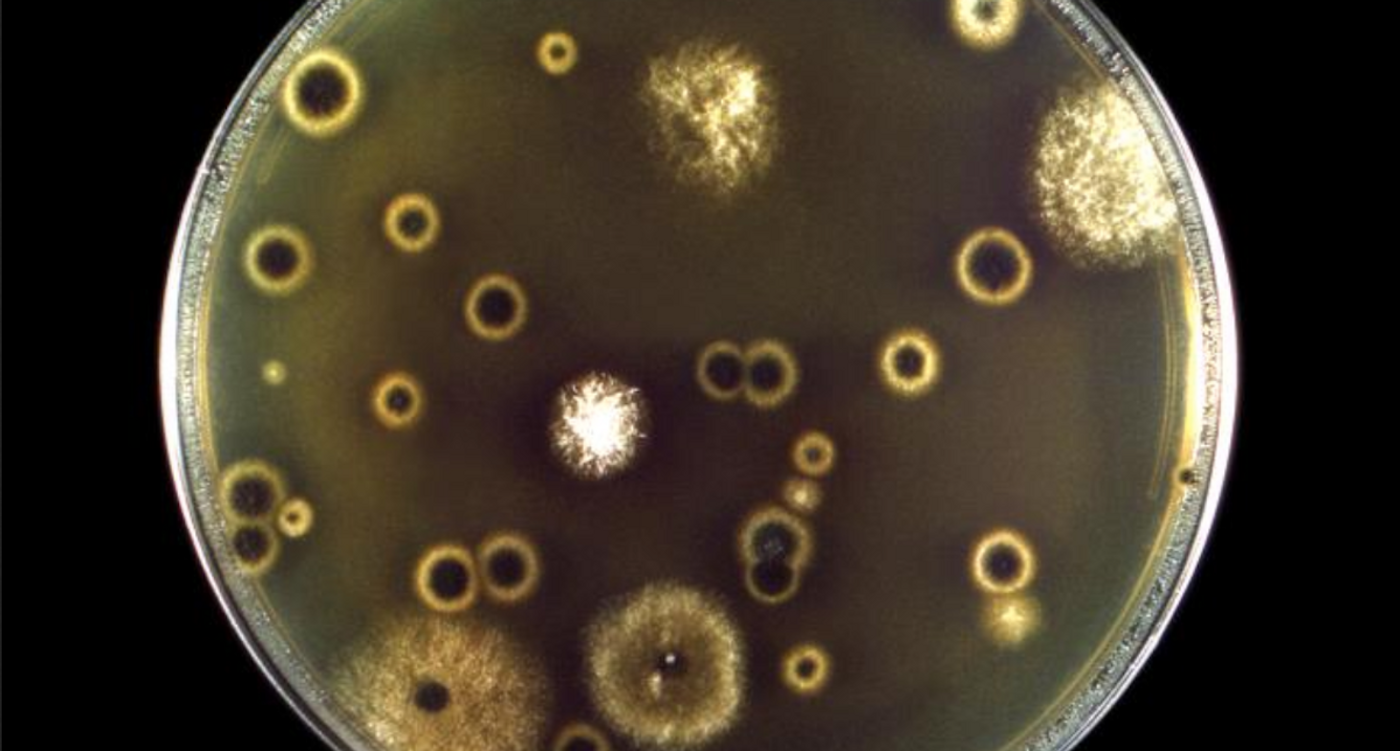 Cryptococcus neoformans fungal organisms growing in a Petri dish containing Ajello-Shields growth medium / Credit: Centers for Disease Control and Prevention (CDC) / Dr. Libero Ajello