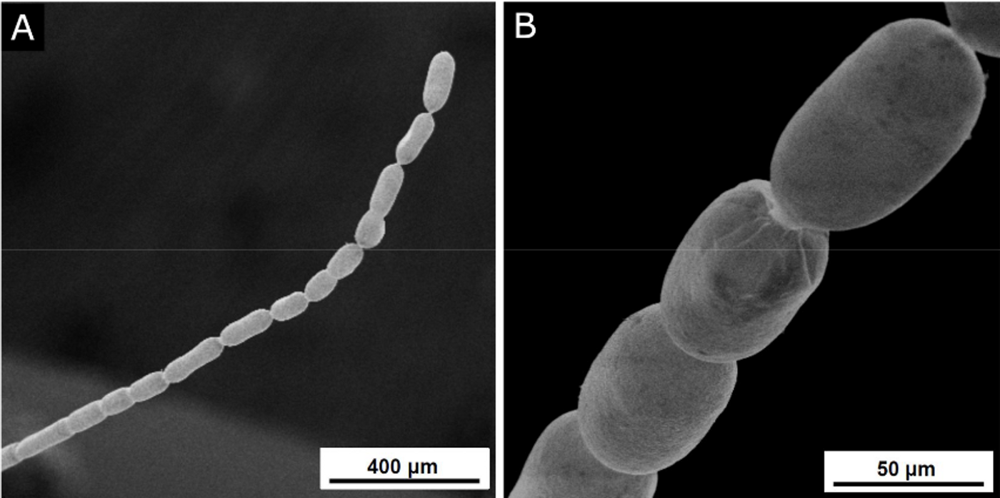 Scanning electron microscopy observation of an individual Ca. Thiomargarita magnifica / Image credit: © Volland et al bioRxiv 2022