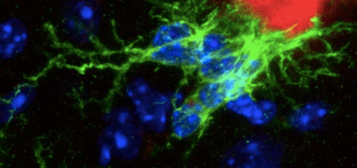 Microglia can be seen here in green, cropped from an image by Laura Sebastian Monasor eLife 2020 / CC4.0 https://creativecommons.org/licenses/by/4.0/
