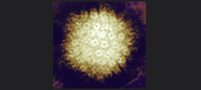 Varicella-zoster Virus / Credit: NIAID