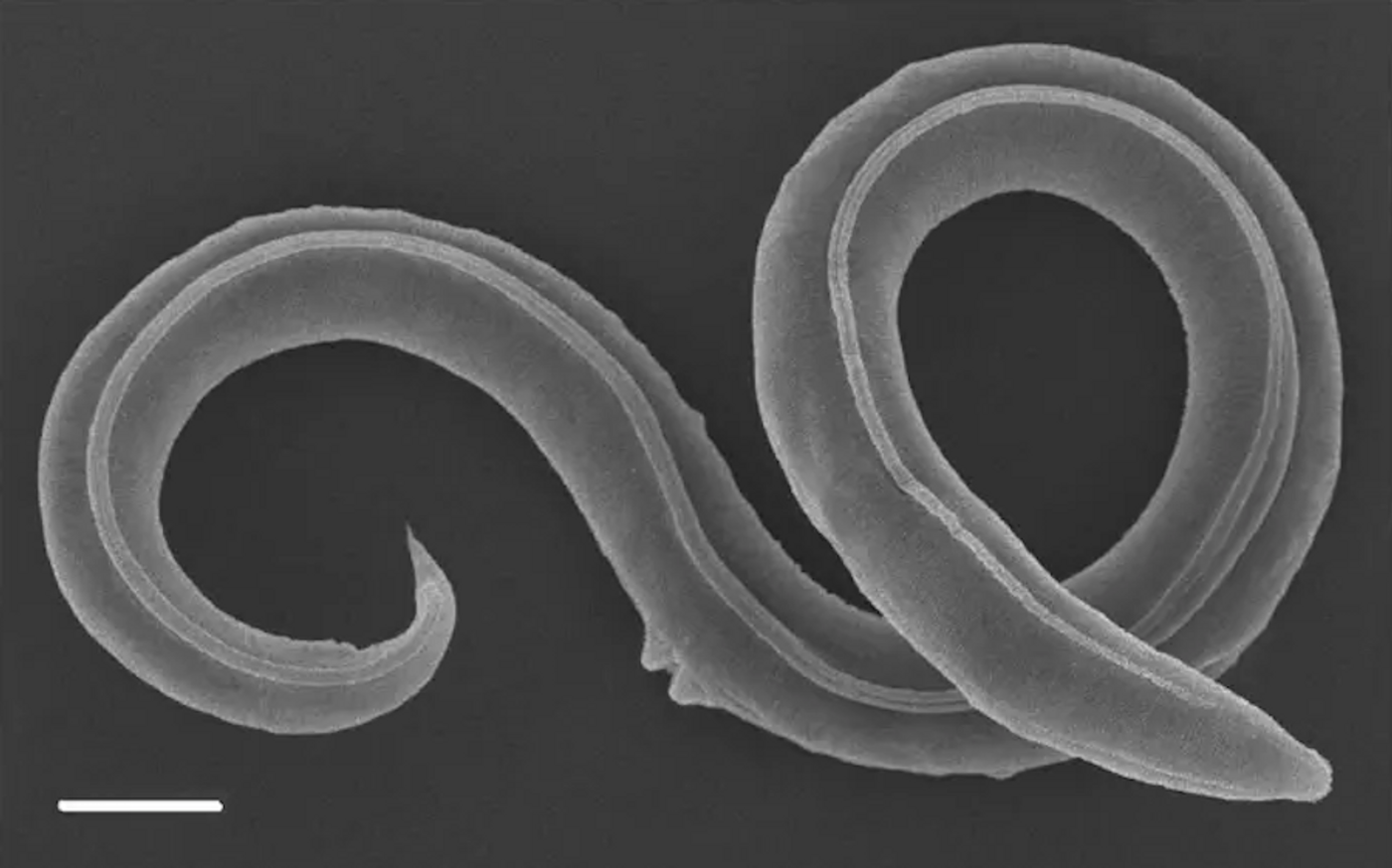 Scanning electron image of P. kolymaensis, female. / Credit: Alexei V. Tchesunov and Anastasia Shatilovich / Institute of Physicochemical and Biological Problems in Soil Science RAS