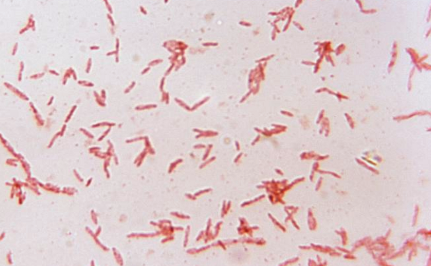 A photomicrograph of numerous Bacteroides clostridioforme subsp. girans bacteria / Credit: CDC/ Dr. V.R. Dowell, Jr.