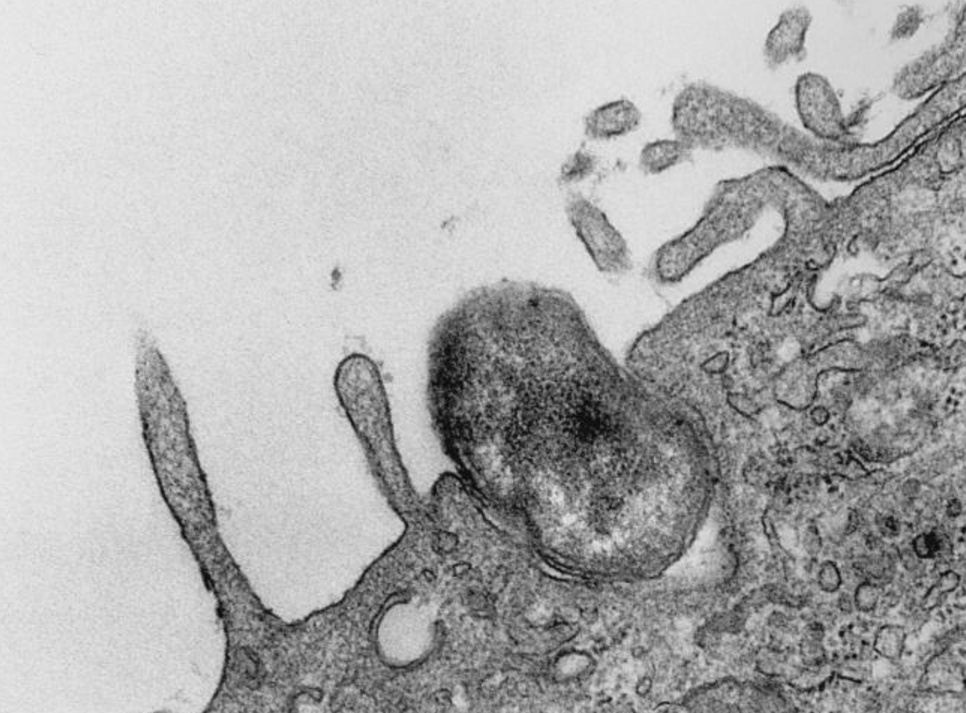 A TEM image was captured as the process of phagocytosis was underway. An Orientia tsutsugamushi bacterium was being ingested by a mouse peritoneal mesothelial cell. / Credit: CDC/ Dr. Edwin P. Ewing, Jr.