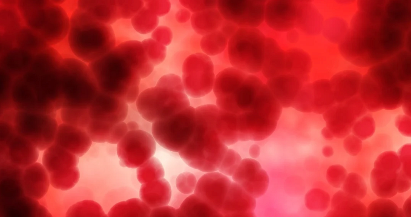 Image credit: Pixabay