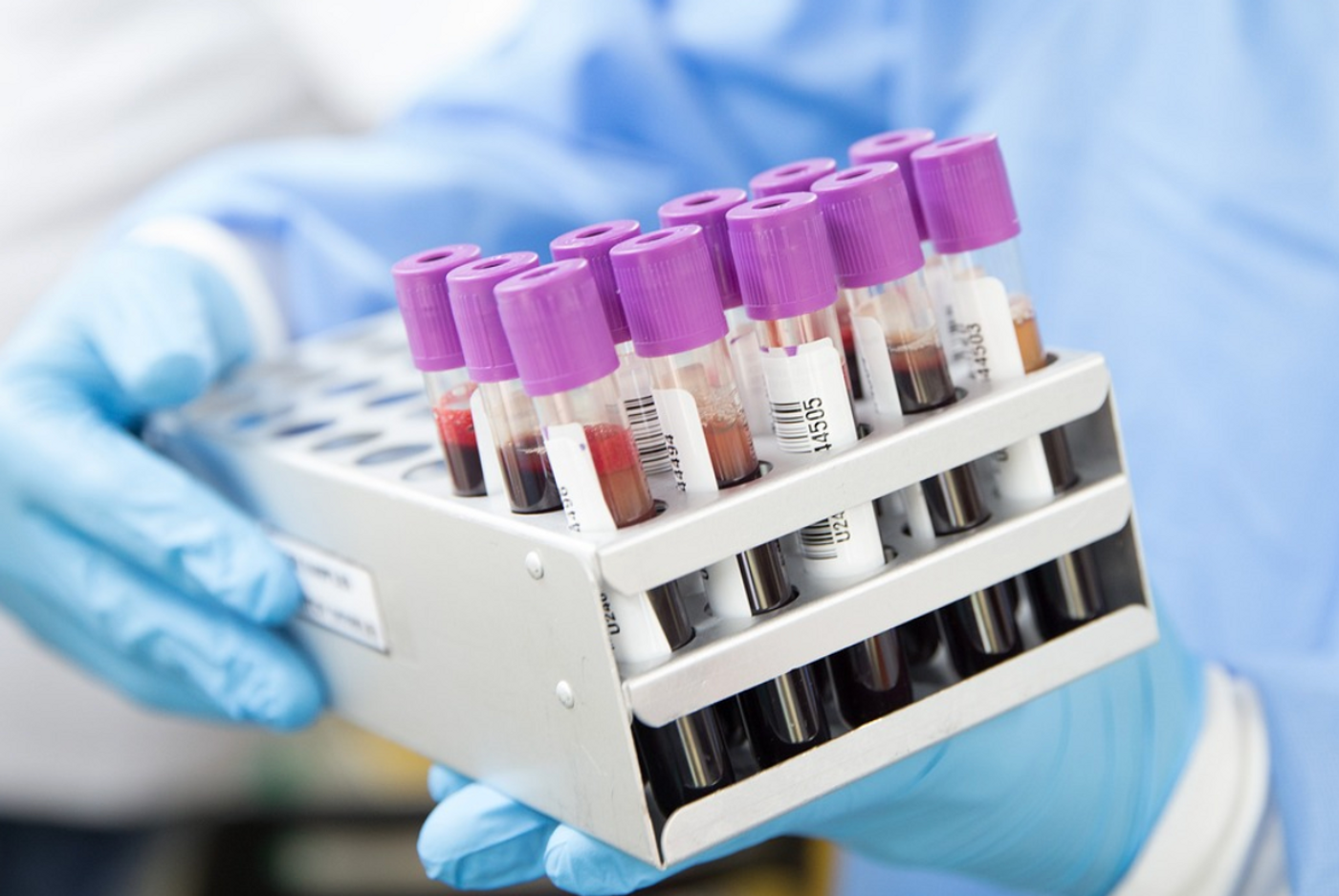 Image credit: Pixabay