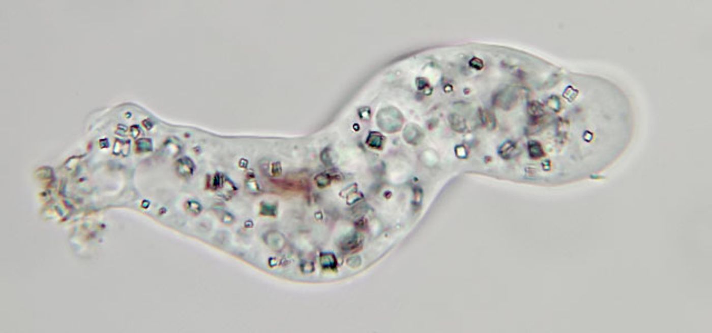Protists like this one prey on bacteria.