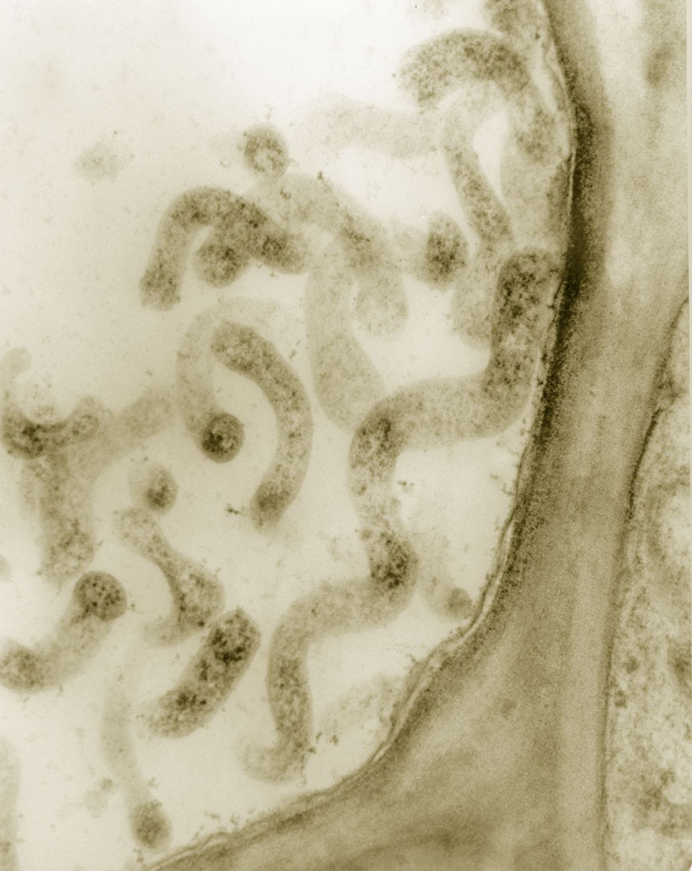 Spiroplasma are spiral-shaped bacteria.