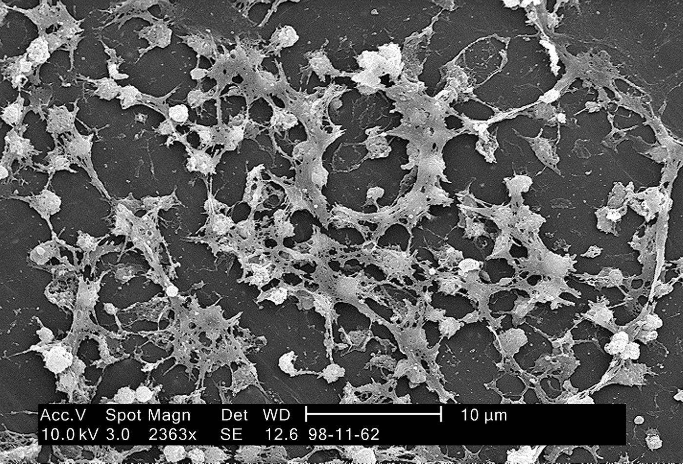 Electron micrograph depicting large numbers of Staphylococcus aureus bacteria  on the luminal surface of an indwelling catheter./ Credit: CDC
