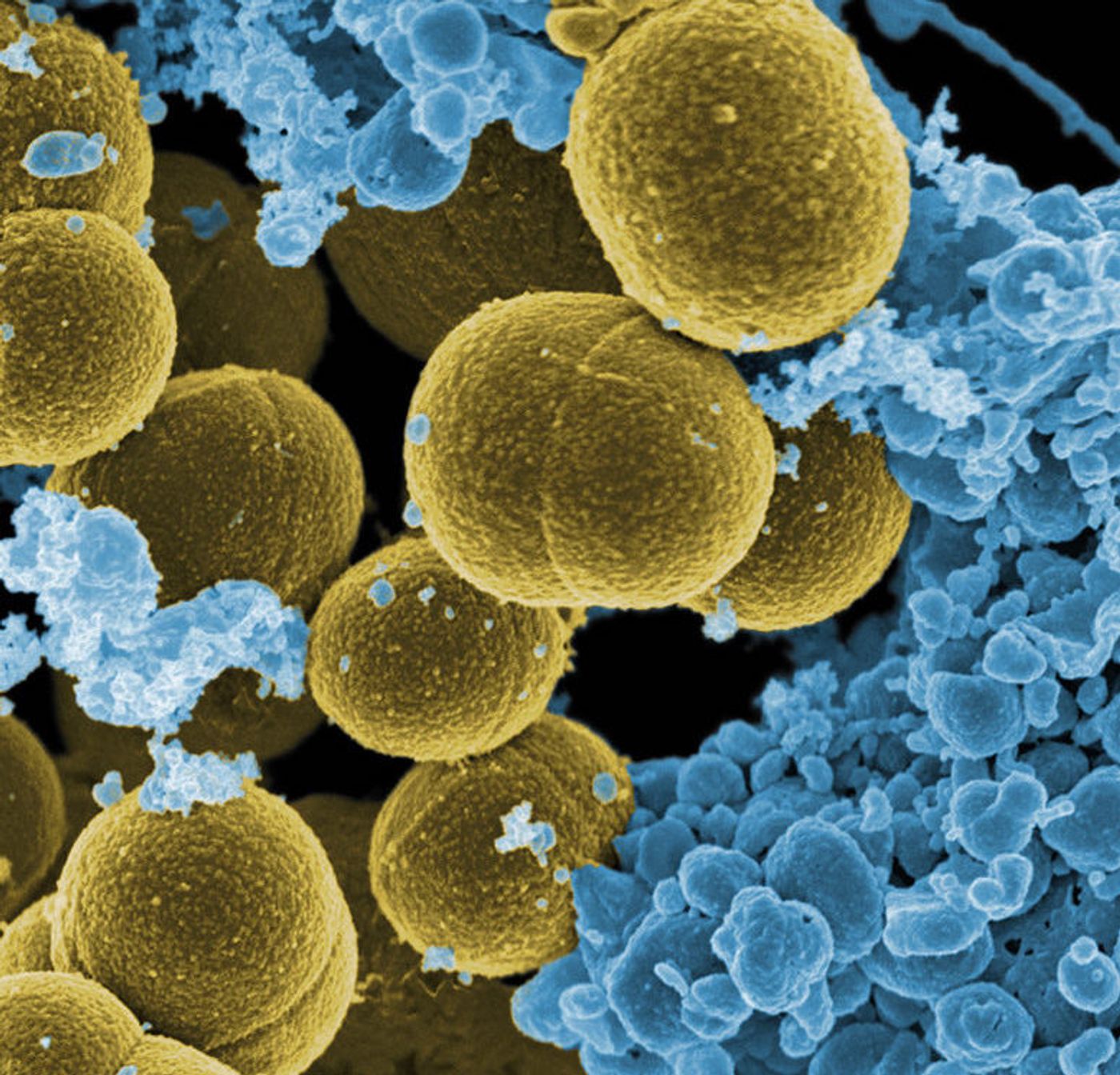 Scanning electron micrograph of S. aureus bacteria escaping destruction by human white blood cells./ Credit: NIAID