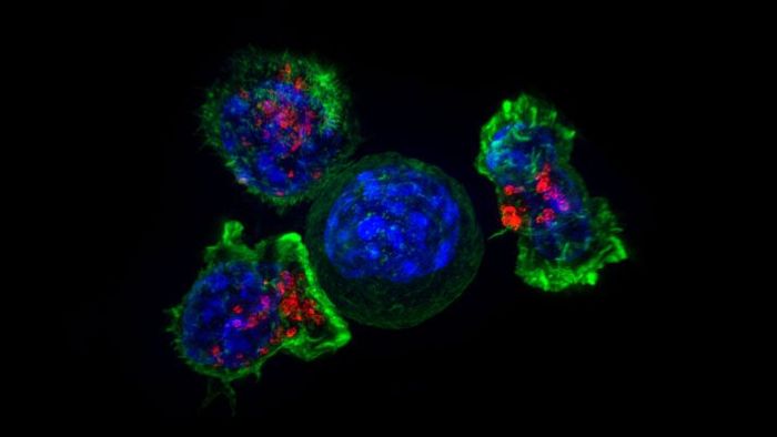 Killer T cells (green and red) surrounding a cancer cell.