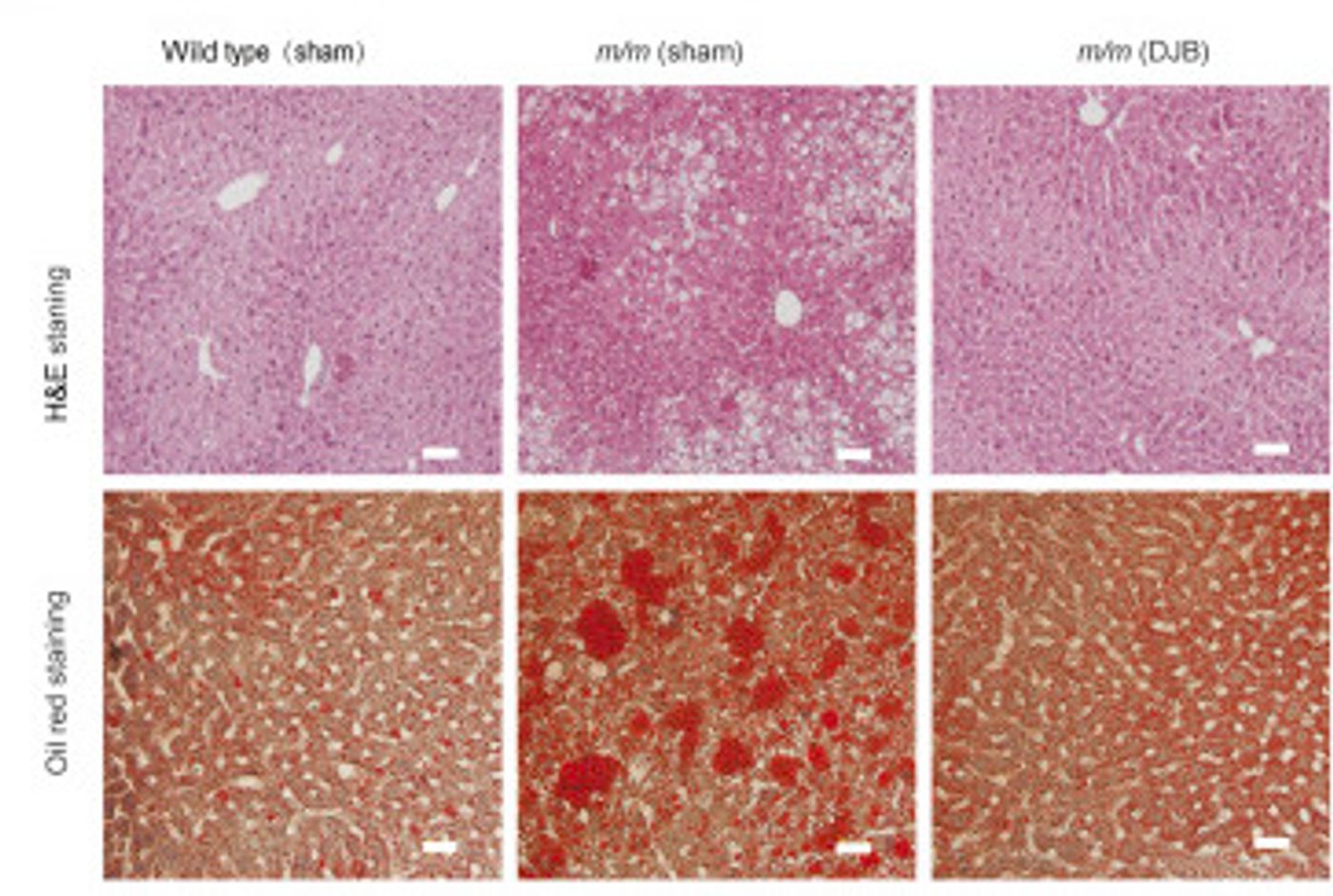 Lipid accumulation is reversed in livers of DJB male T2DM mice. - Representative H&E and oil red O staining of livers of T2DM mice 9 weeks after DJB surgery / Credit: American Journal of Pathology Jiang et al