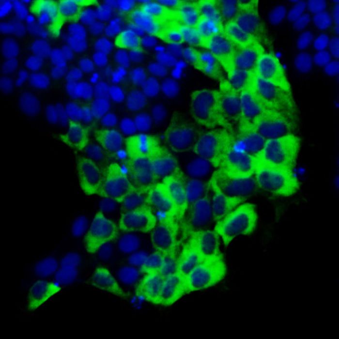 The protein TAZ (green) in the cytoplasm (the region outside of the nuclei, blue) promotes the self-renewal of human embryonic stem cells. / Credit: Xingliang Zhou/Ying Lab, USC Stem Cell