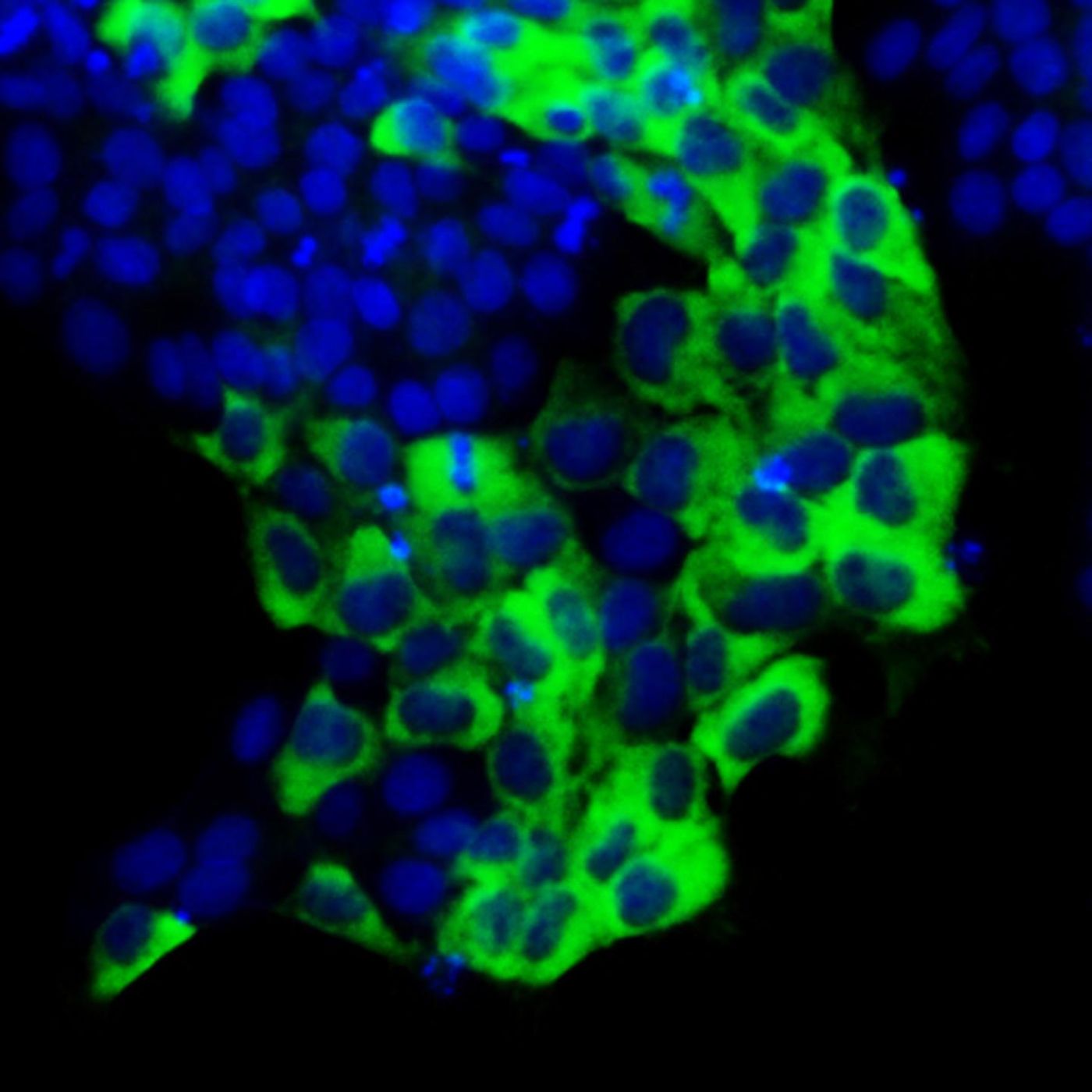 The protein TAZ (green) in the cytoplasm (the region outside of the nuclei, blue) promotes the self-renewal of human embryonic stem cells. / Credit: Xingliang Zhou/Ying Lab, USC Stem Cell
