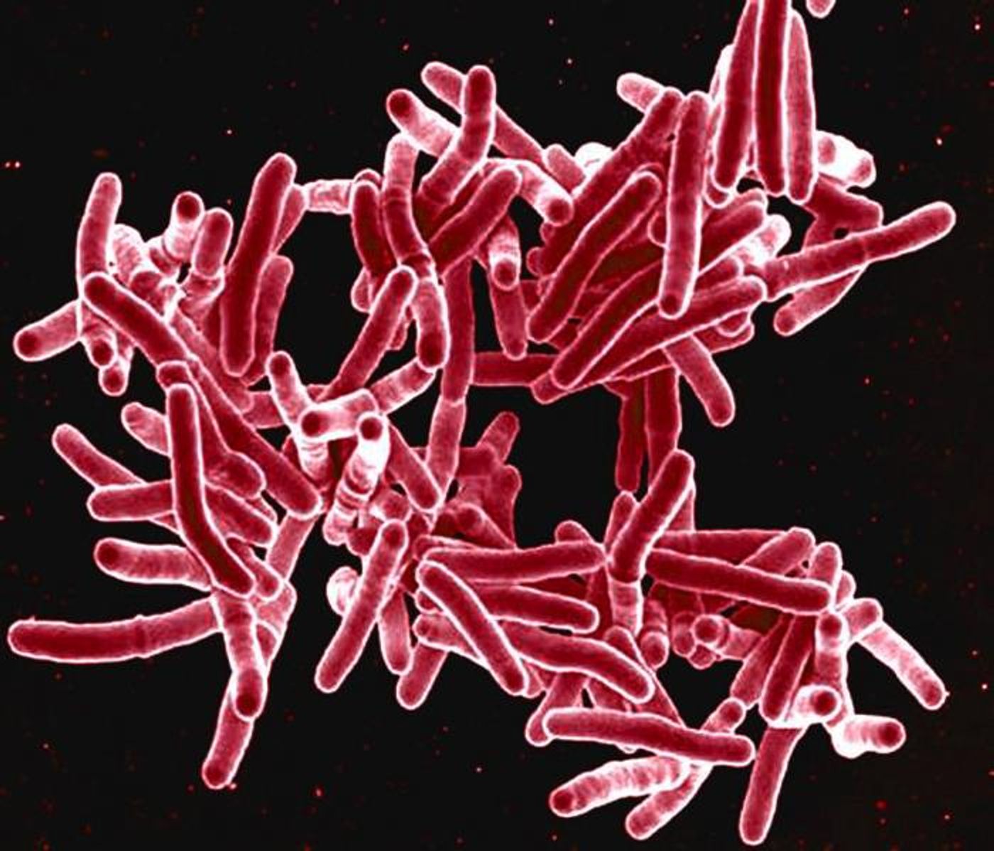 Colorized scanning electron microscopic (SEM) image of red colored, rod shaped, Mycobacterium tuberculosis bacteria, which cause tuberculosis (TB) in human beings. / Credit: National Institute of Allergy and Infectious Diseases