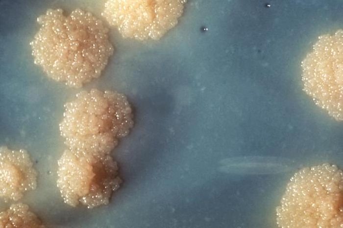 This is a close-up of a Mycobacterium tuberculosis culture revealing this organism's colonial morphology. Note the colorless rough surface, which are typical morphologic characteristics seen in Mycobacterium tuberculosis colonial growth. / Credit: Centers for Disease Control and Prevention/Dr. George Kubica