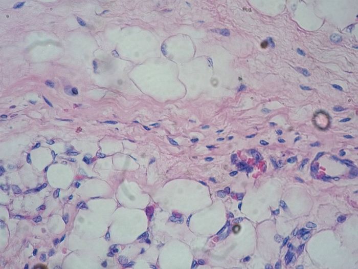 Photograph of a preparation of adipose tissue under an optical microscope; 400X; Staining with hematoxylin-eosin. Credit Wikimedia User Ganímedes
