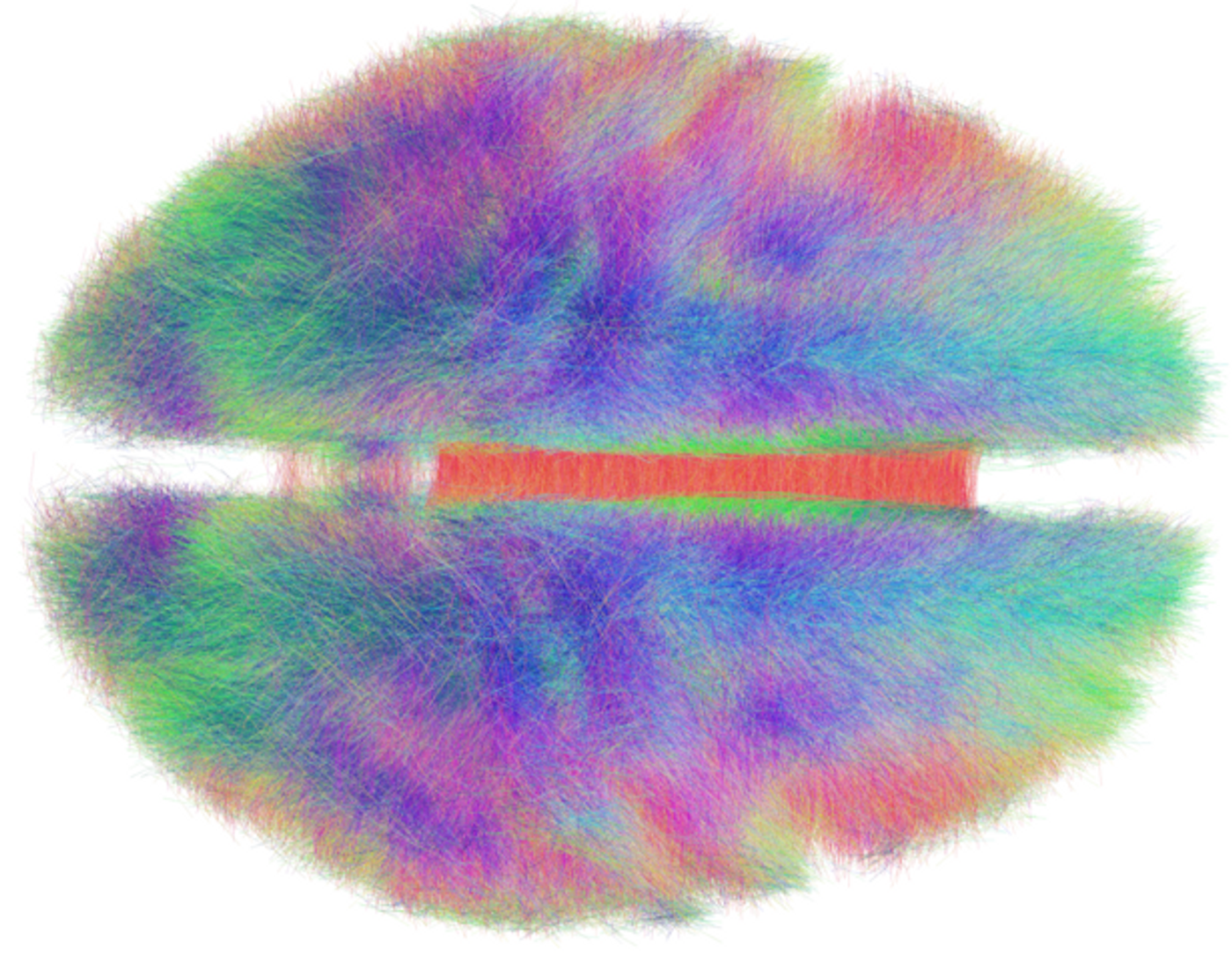 The human connectome