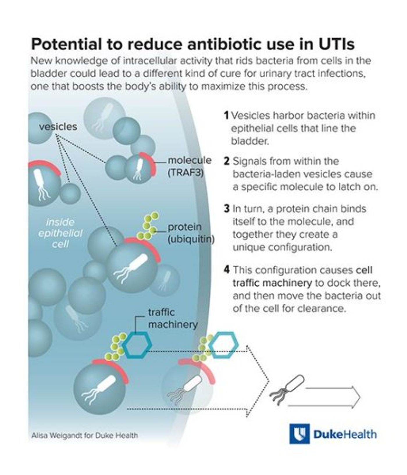 New knowledge of intracellular activity that rids bacteria from cells in the bladder could lead to a different kind of cure for urinary tract infections, one that boosts the body's ability to maximize this process. / Credit: Alisa Weigandt for Duke Health