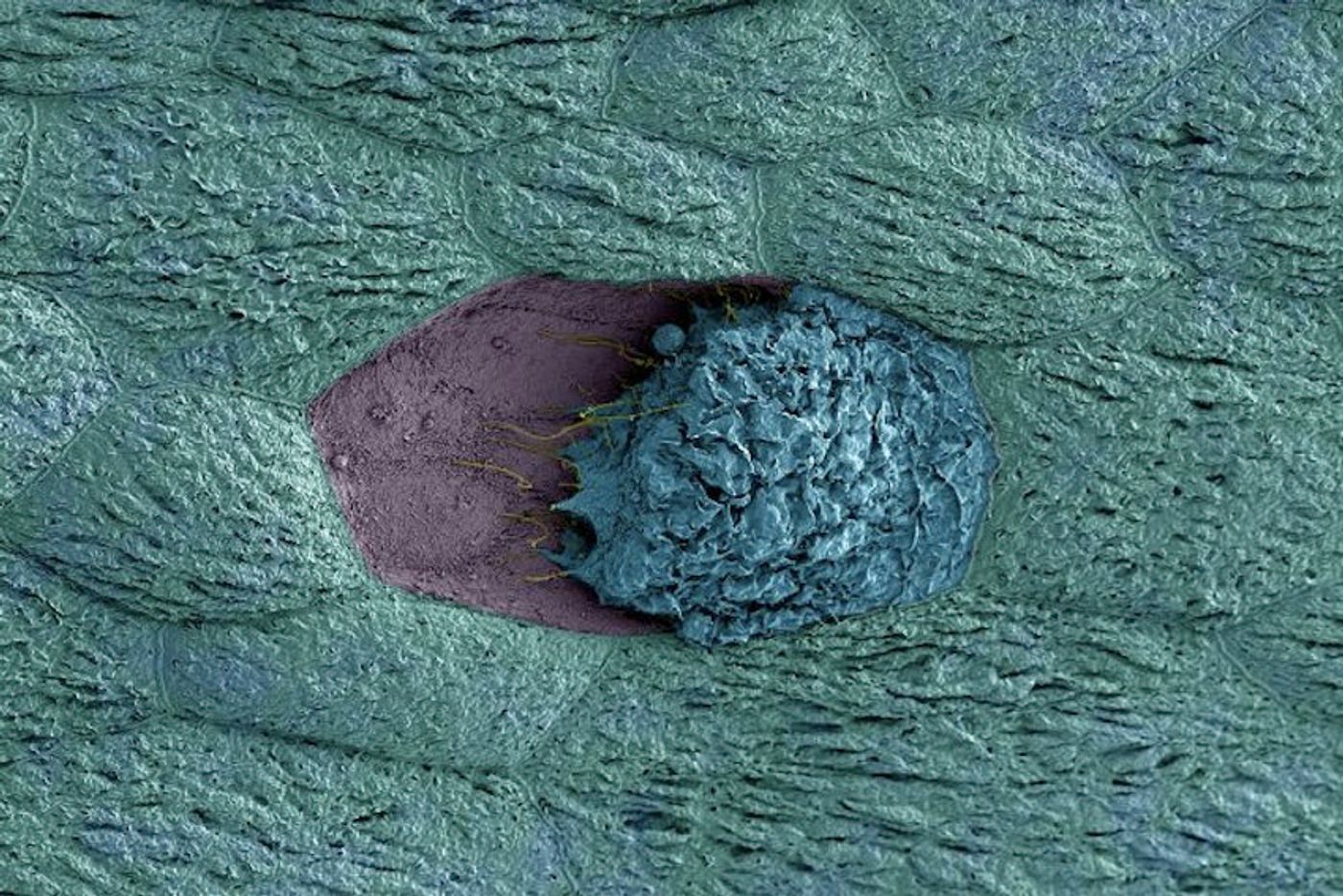 In the image above, a bladder cell (blue) that has been exposed to G. vaginalis is dying and detaching from its neighboring cells (teal), revealing immature cells below (purple). / Credit: Matthew Joens, James Fitzpatrick and Nicole Gilbert