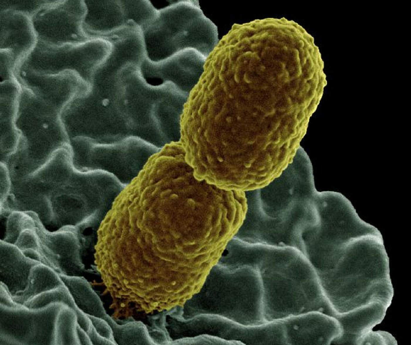 Colorized scanning electron micrograph showing Klebsiella pneumoniae interacting with a human neutrophil. Credit: NIAID