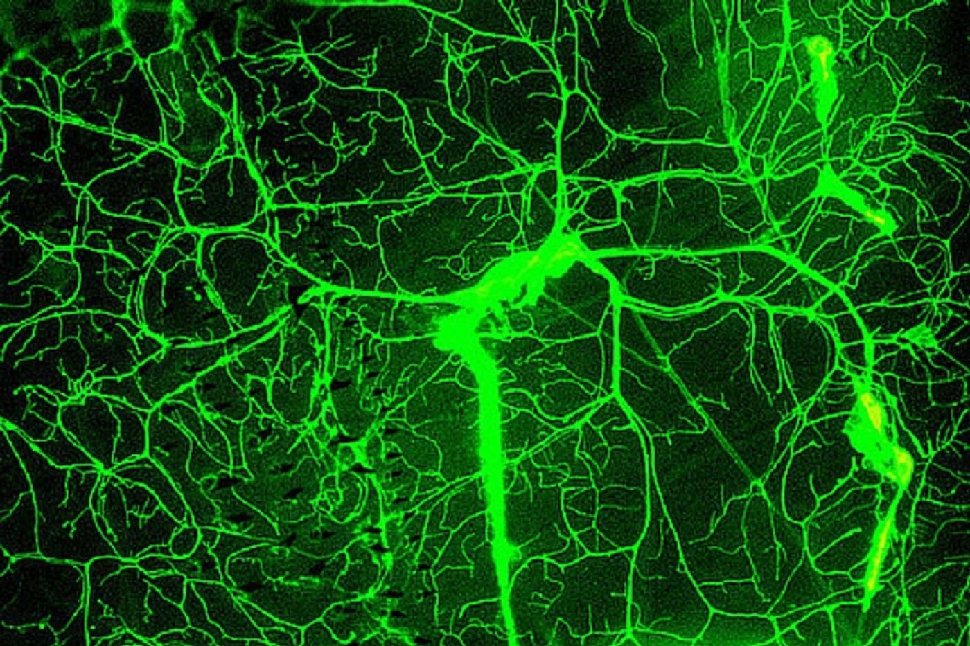 Blood vessels surrounding the brain are designed to keep out toxins