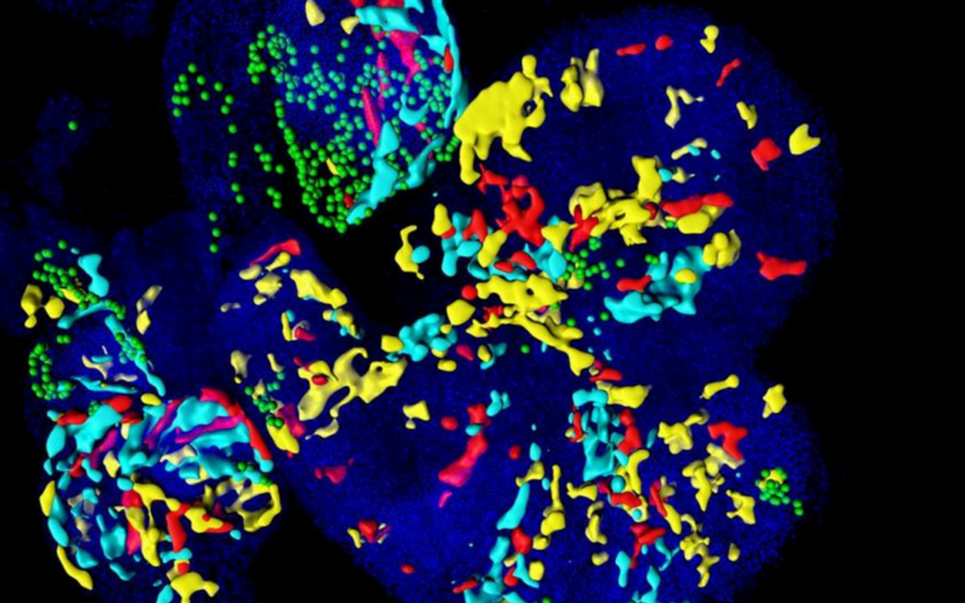 This is a mosaically labeled embryonic heart. Each colored patch is derived from the early labeling of a cardiac progenitor cell expressing the key gene Mesp1. Credit: Fabienne Lescroart