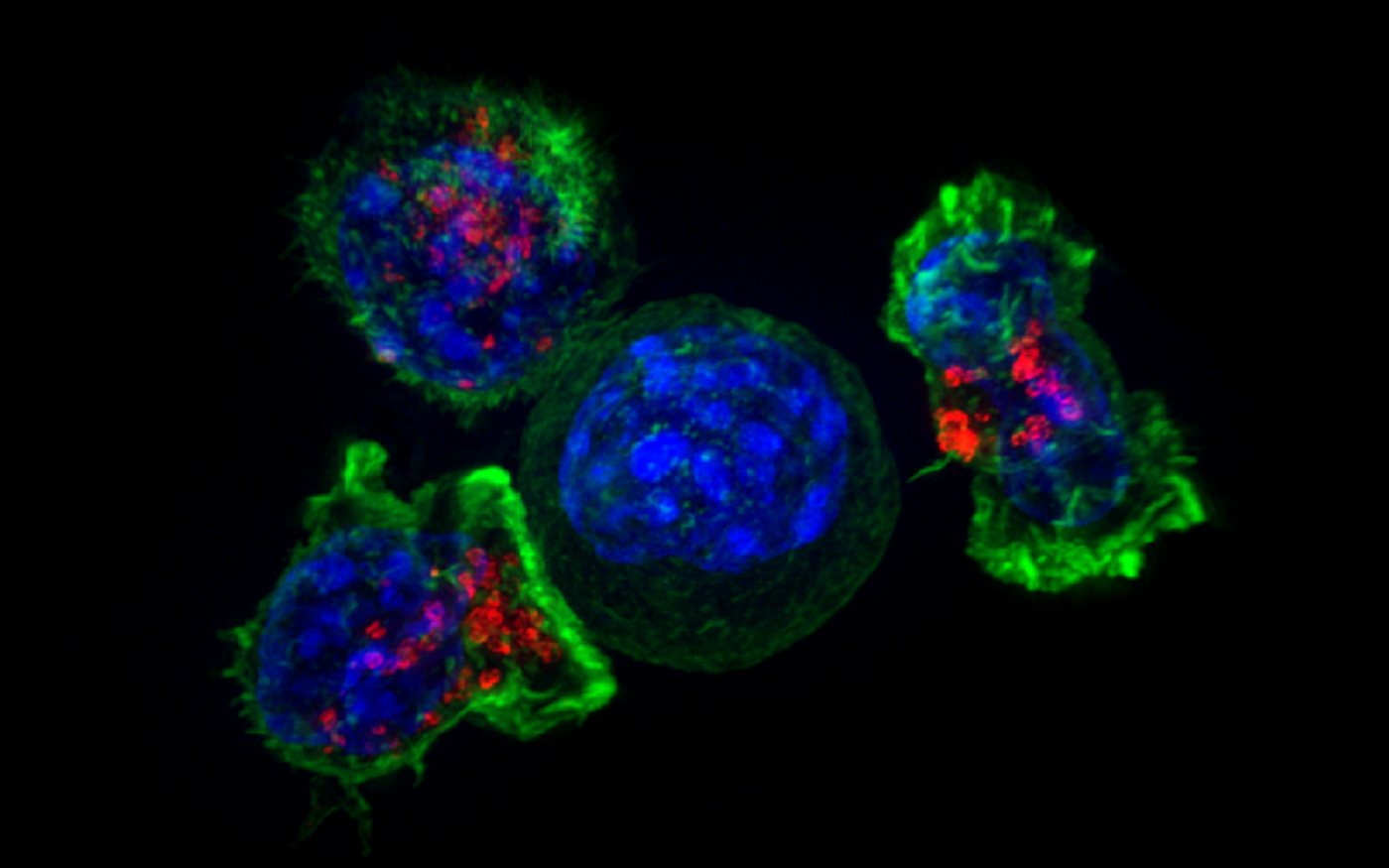 A group of killer T cells (green and red) surrounding a cancer cell (blue, center). Killer T cells use special chemicals to kill cancer cells. Credit: National Institutes of Health