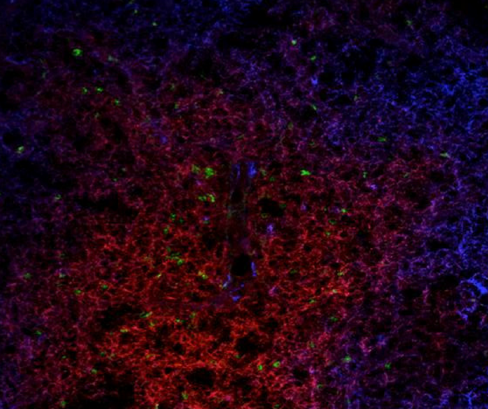 A lymph node with  normal T cells (red) and Treg cells regulated by the FOXP3 gene (green). Credit: Ciriaco Piccirillo, Research Institute of the McGill University Health Centre