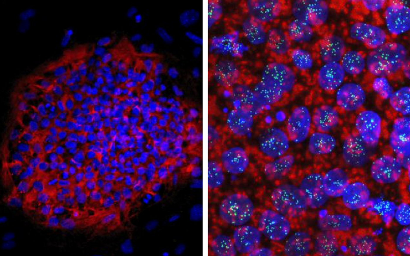 Colonies of human haploid embryonic stem cells. Credit: Azrieli Center for Stem Cells and Genetic Research, Hebrew University of Jerusalem