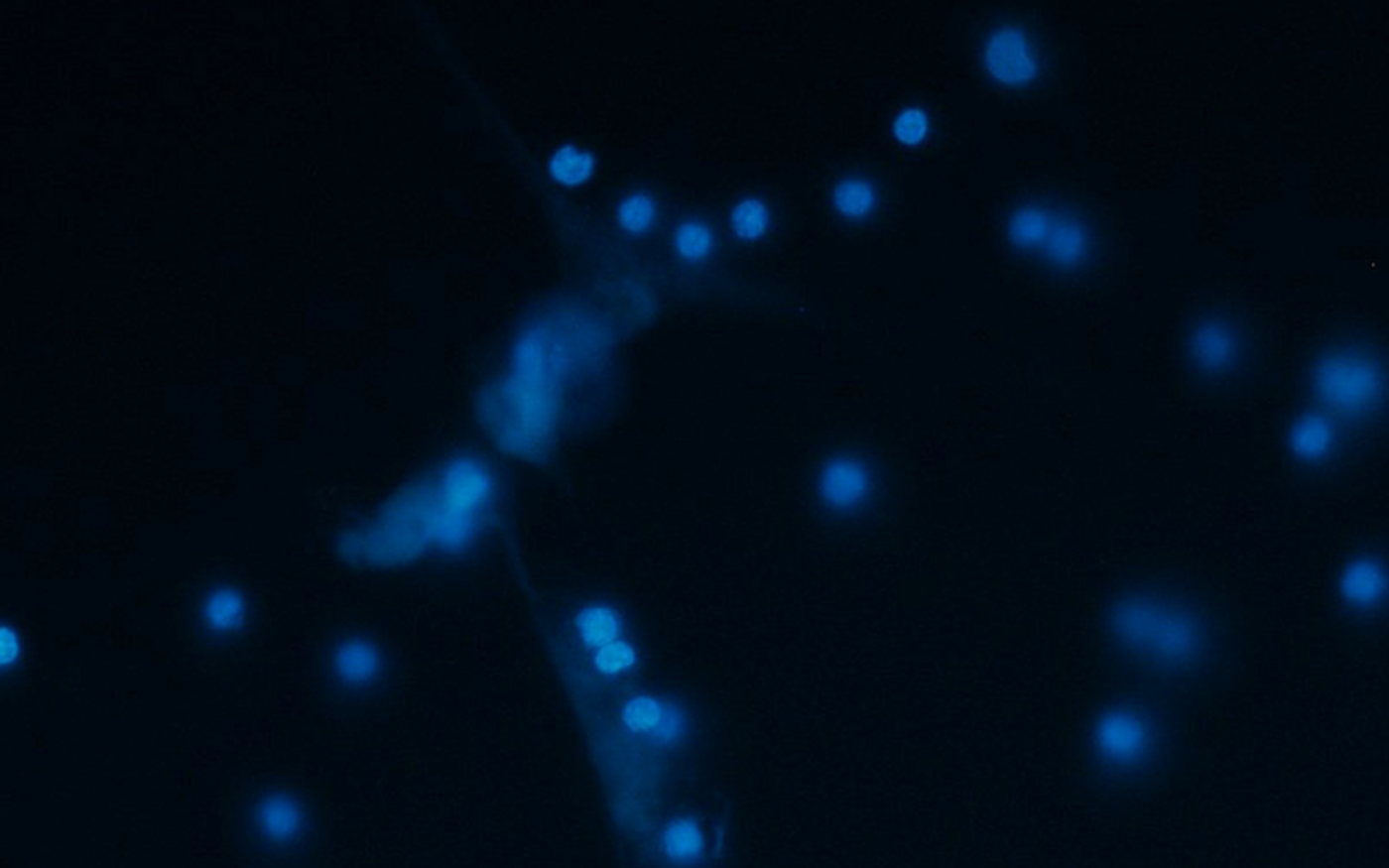 Fluorescent image of cultivated neutrophils isolated from venous blood of human with Alzheimer Disease. Credit: Wikimedia user Ltumanovskaya