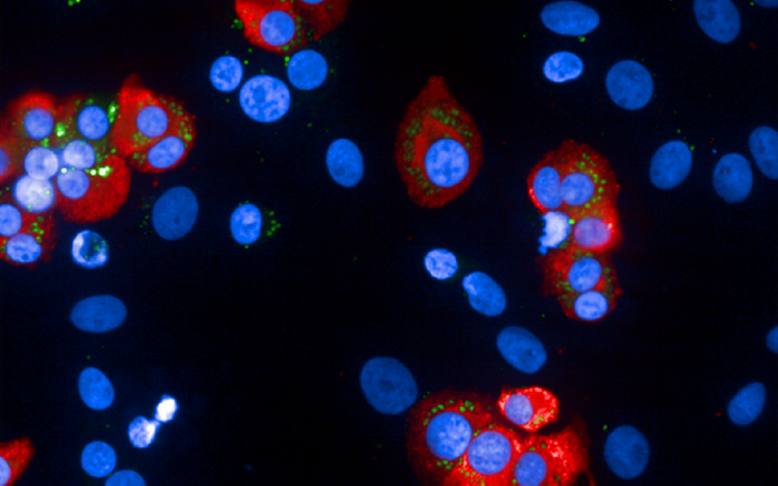 Human beta cells and insulin granules. Credit: Wikimedia user Wikimaji