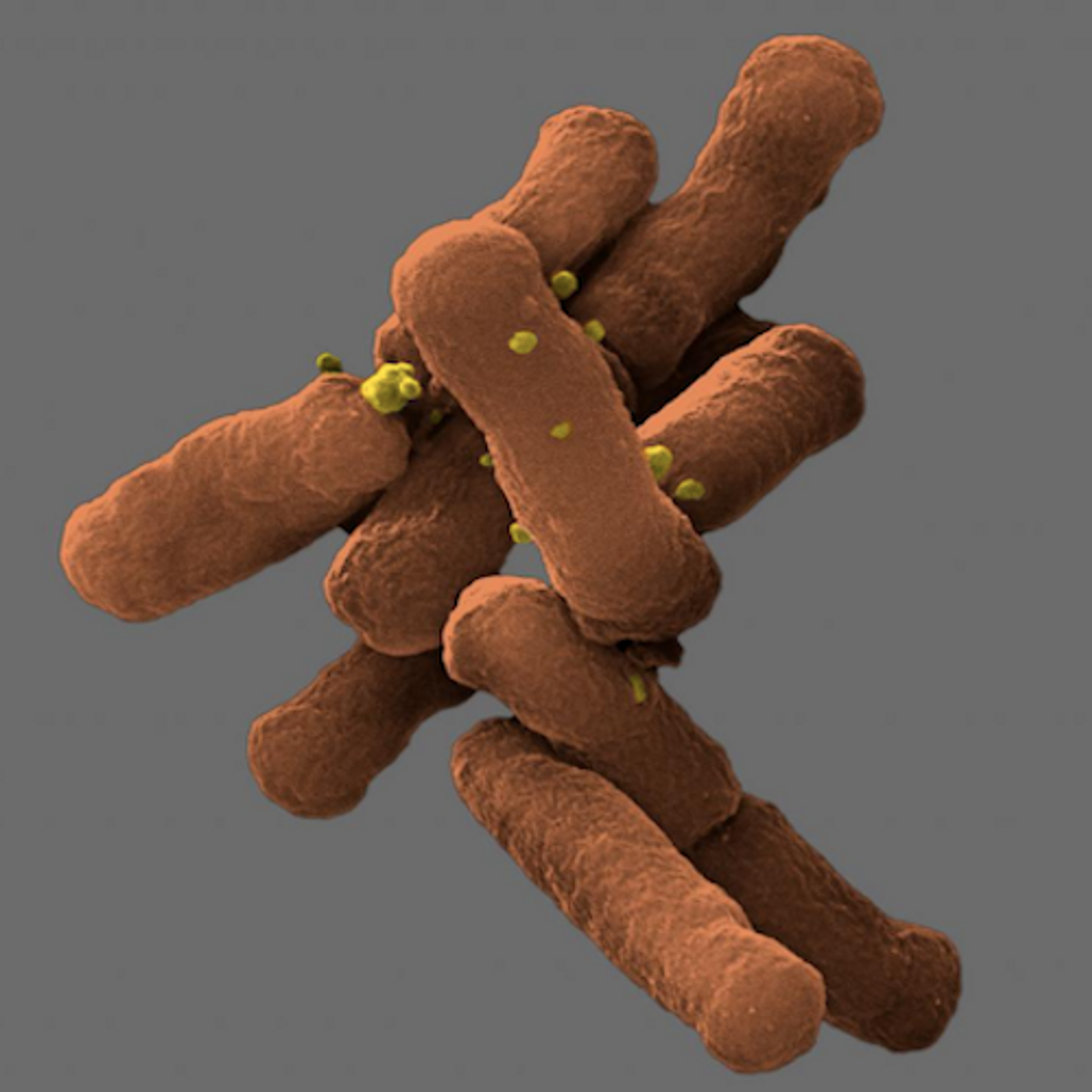 By isolating D. oralis, ORNL scientists could better understand how the microbes may have adapted and evolved to become dependent on other oral bacteria, as well as how losing or acquiring genes can make them friend or foe./ Credit: Karissa Cross/Oak Ridge National Laboratory, US Dept. of Energy