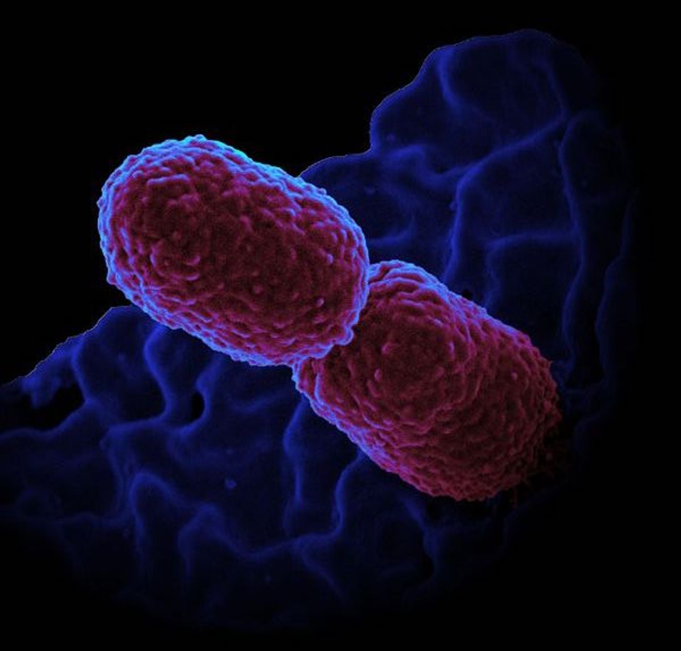 Klebsiella pneumoniae Bacterium / Credit: NIAID