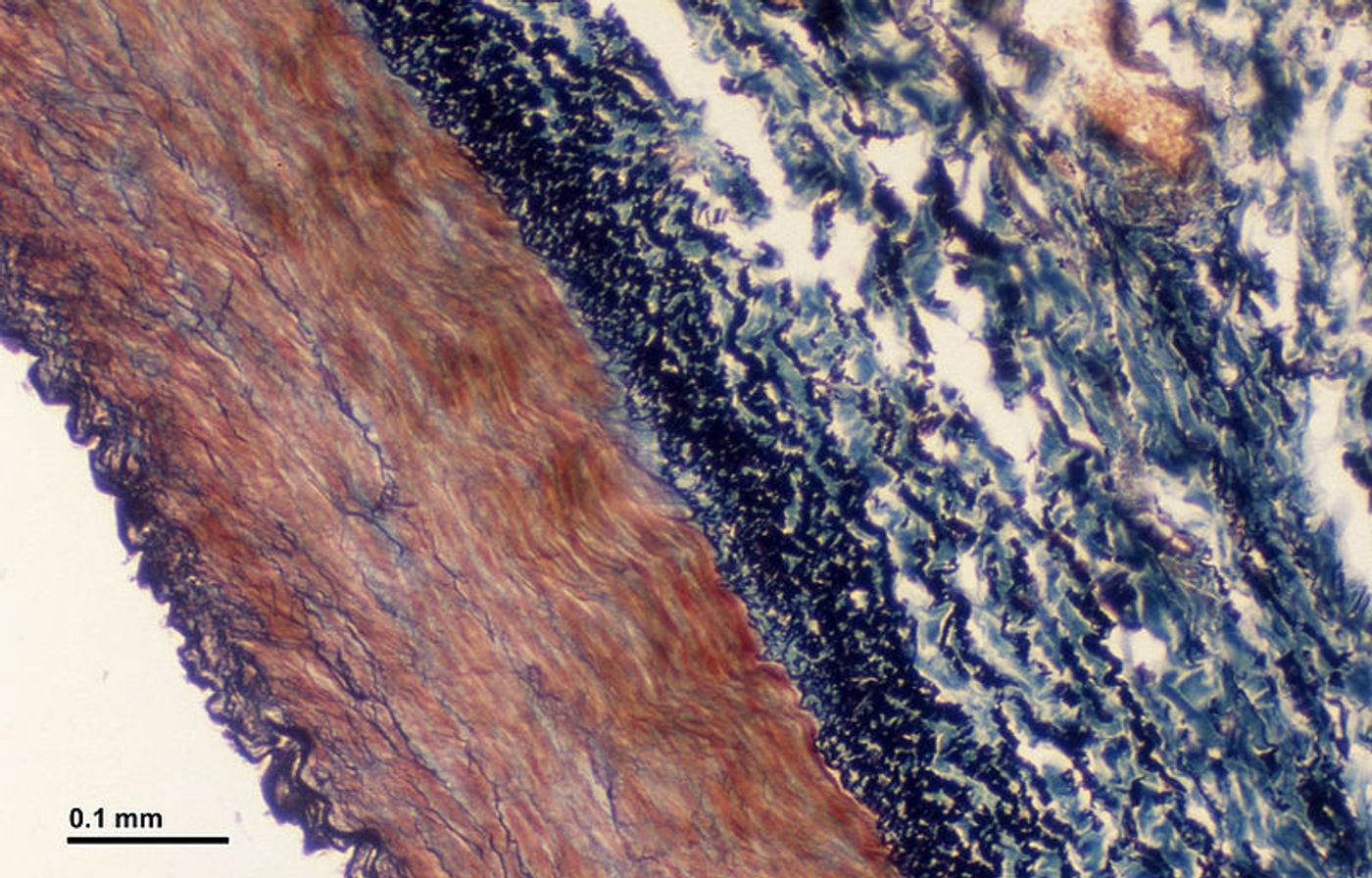 A cross-section of a blood vessel, with the different protective layers evident. Credit: Josef Reischig, CSc.