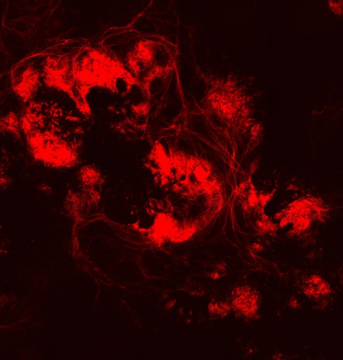 Lab-grown retinal nerve cells glow red at day 50.