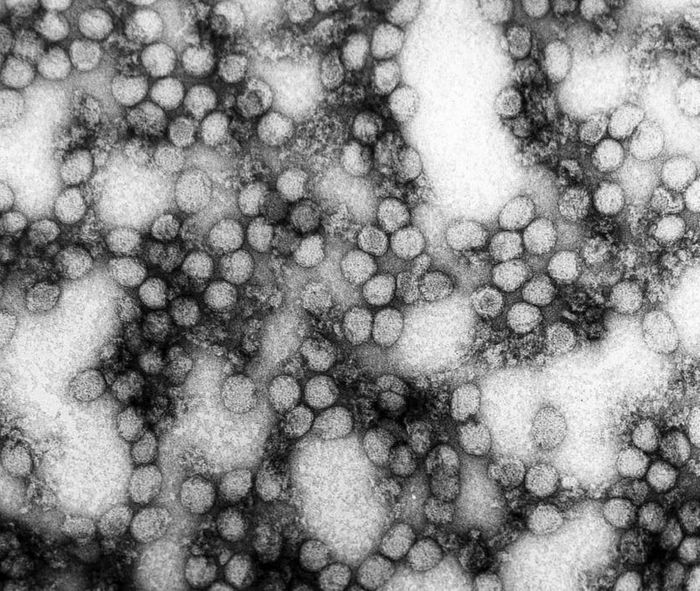 Yellow fever virus. Credit: Erskine Palmer, Ph.D. - CDC Public Health Image Library