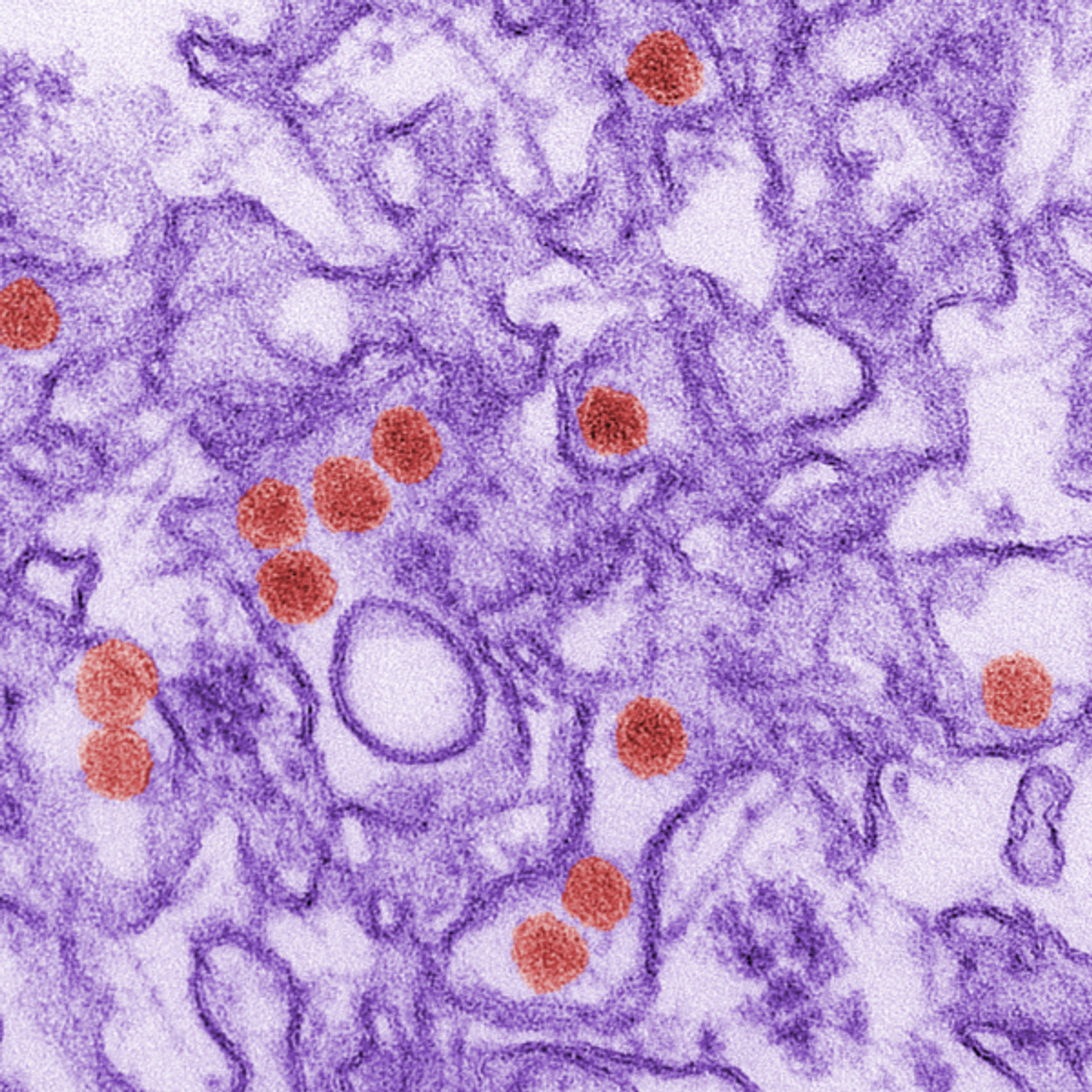 A digitally-colorized transmission electron micrograph of Zika virus, which is a member of the family Flaviviridae. Virus particles are colored red,