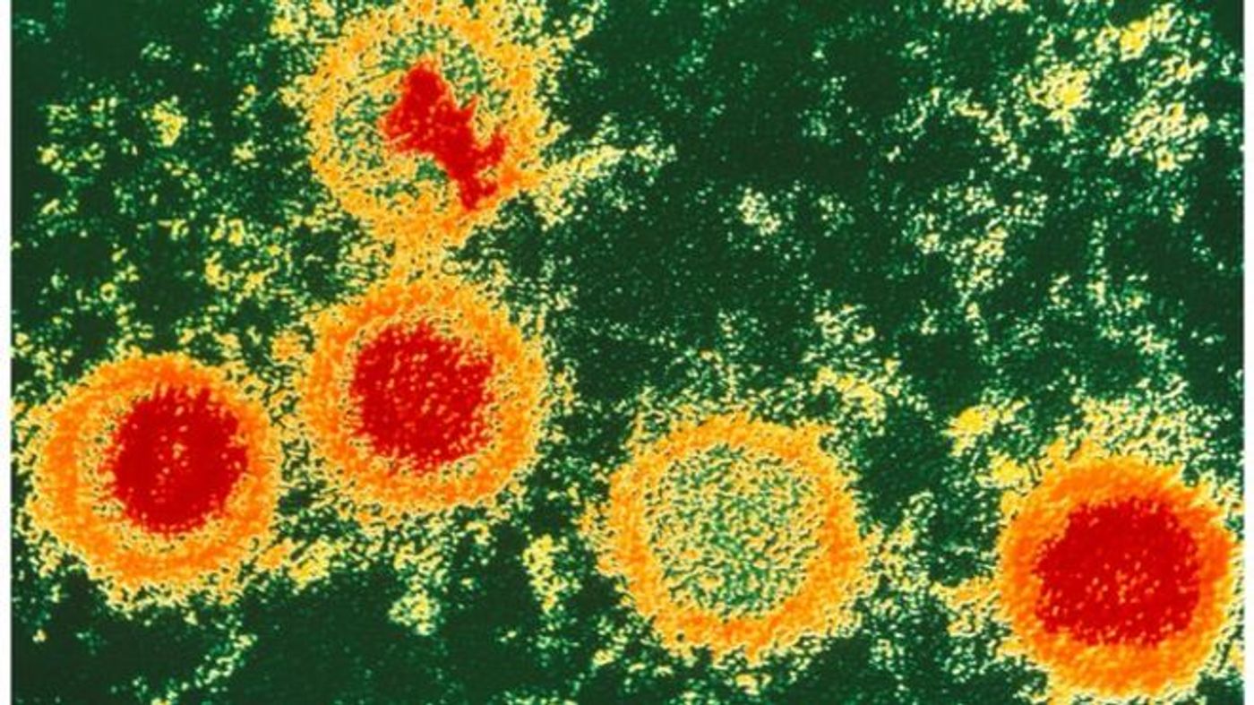 Epstein-Barr virus particles