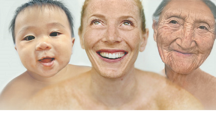 Accelerated ageing (AA) has been associated with obesity, Down's syndrome and HIV.